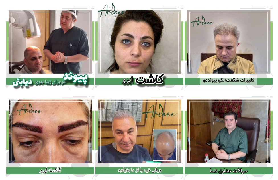 معرفی کلینیک تخصصی کاشت مو و ابروی دکتر امیرعلی موسوی