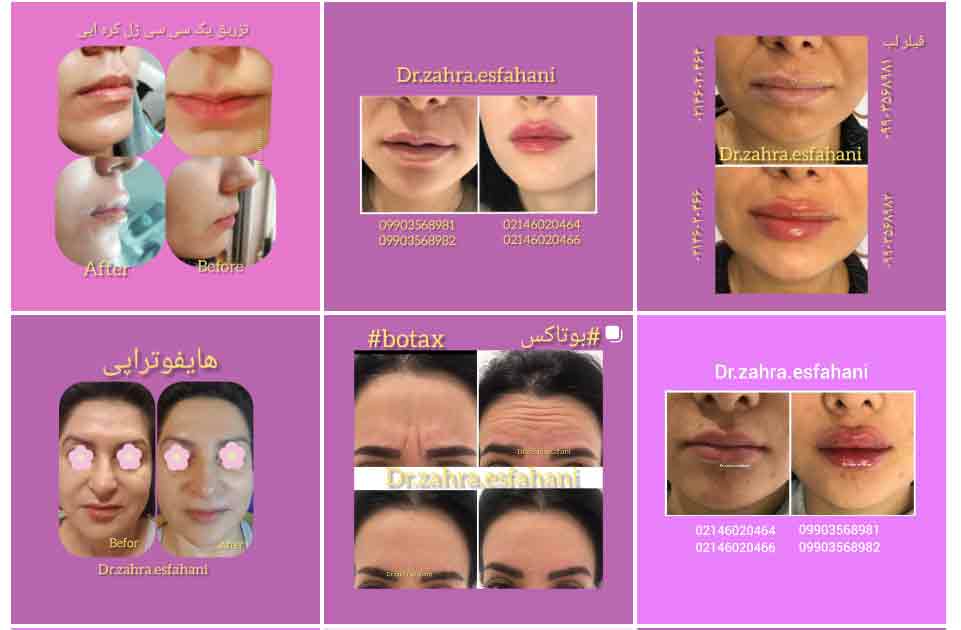مرکز فیشیال دکتر زهرا اصفهانی