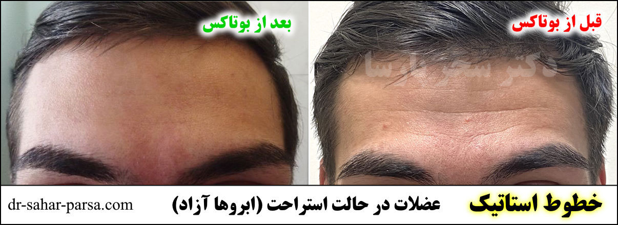 کلینیک دکتر سحر پارسا بهترین مرکز بوتاکس شرق تهران