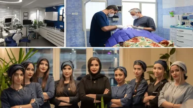بهترین مرکز فیلر زیر چشم تهران